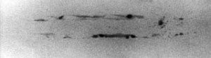 inclusioni-di-scoria-radiografia